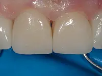 Gutzwiller Dental - Klicken Sie, um das Bild 1 in einer Lightbox vergrössert darzustellen