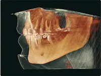Zahnärztliches Zentrum Wallisellen - Klicken Sie, um das Bild 5 in einer Lightbox vergrössert darzustellen