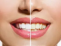 Clinique dentaire Cornavin – Cliquez pour agrandir l’image 2 dans une Lightbox