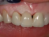 Gutzwiller Dental - cliccare per ingrandire l’immagine 7 in una lightbox