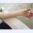 bandagierter arm