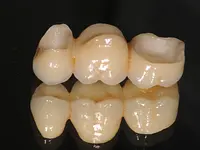 Gutzwiller Dental - cliccare per ingrandire l’immagine 5 in una lightbox