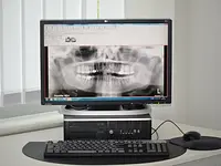 Dr. med. dent. Leuzinger Nils | Zahnarztpraxis Rosenberg - Klicken Sie, um das Bild 7 in einer Lightbox vergrössert darzustellen