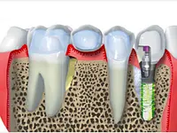 Dental Center Tafers - cliccare per ingrandire l’immagine 1 in una lightbox