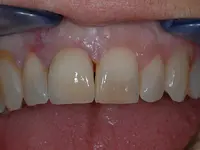 Gutzwiller Dental - Klicken Sie, um das Bild 3 in einer Lightbox vergrössert darzustellen
