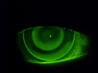 Fleury Opticiens SA - Klicken Sie, um das Bild 7 in einer Lightbox vergrössert darzustellen