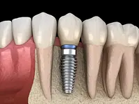 Clinique Dentaire de Meyrin - cliccare per ingrandire l’immagine 19 in una lightbox