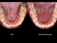 Cabinet dentaire de Bernex – Cliquez pour agrandir l’image 5 dans une Lightbox