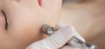 Microdermabrasion