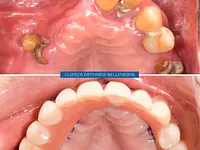 Clinica Dentaria Bellinzona Schulthess & Ottobrelli – Cliquez pour agrandir l’image 4 dans une Lightbox