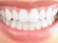 Dr J-B Pégorier - Dental Pearl - Soins Dentaires et Esthétique - cliccare per ingrandire l’immagine 5 in una lightbox