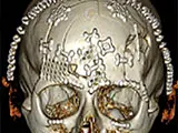 Fachärzte FMH für Kiefer- und Gesichtschirurgie Pionierpark - Klicken Sie, um das Bild 23 in einer Lightbox vergrössert darzustellen