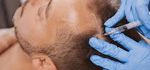 PRP-Therapie