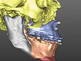 Fachärzte FMH für Kiefer- und Gesichtschirurgie – Cliquez pour agrandir l’image 15 dans une Lightbox