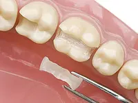 K-Dent médecine dentaire Zahnmedizin – Cliquez pour agrandir l’image 2 dans une Lightbox