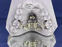 Orthodontic Lab – Cliquez pour agrandir l’image 3 dans une Lightbox