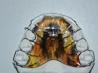 Dental Design ILG – click to enlarge the image 2 in a lightbox