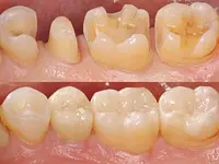 Clinique Dentaire d'Onex - cliccare per ingrandire l’immagine 15 in una lightbox