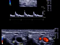 Echographie à domicile, radiologie Genève Dr Lacrosniere - cliccare per ingrandire l’immagine 2 in una lightbox
