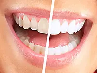 K-Dent médecine dentaire Zahnmedizin – Cliquez pour agrandir l’image 3 dans une Lightbox