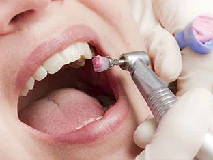 Neric Médecine dentaire I Zahnmedizin