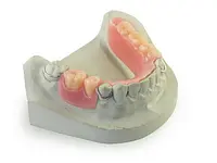 Linder Pro-Dental GmbH - Klicken Sie, um das Bild 3 in einer Lightbox vergrössert darzustellen