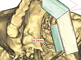 Fachärzte FMH für Kiefer- und Gesichtschirurgie - cliccare per ingrandire l’immagine 17 in una lightbox