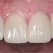 Zahnarztpraxis Dr. Bertschinger /Ästhetische Zahnmedizin
