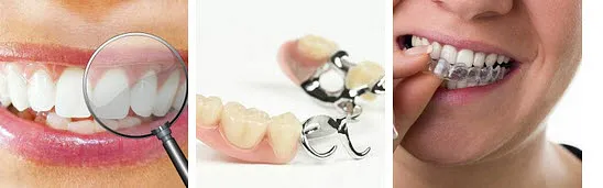 Zahnprothetik Vasi-Dental