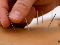 Akupunktur & TCM Heidi Gsteiger - Klicken Sie, um das Bild 13 in einer Lightbox vergrössert darzustellen
