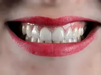 Vinci Dental Concept SA – Cliquez pour agrandir l’image 3 dans une Lightbox