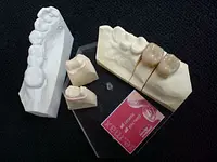 Atelier Zahntechnik / Dental Labor Baden - cliccare per ingrandire l’immagine 2 in una lightbox
