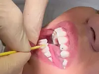 Zahnarztpraxis Jonaport Dr. med. dent. Alexander Kroneberger - Klicken Sie, um das Bild 12 in einer Lightbox vergrössert darzustellen