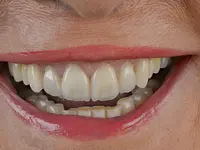Vinci Dental Concept SA – Cliquez pour agrandir l’image 2 dans une Lightbox
