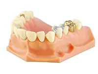 Linder Pro-Dental GmbH - cliccare per ingrandire l’immagine 4 in una lightbox