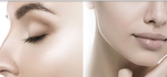 Gesichtschirurgie: Augen | Nase | Fasclifting | Botox-Filler