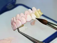 dental moeschli.ch ag - cliccare per ingrandire l’immagine 6 in una lightbox