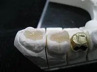 Atelier Zahntechnik / Dental Labor Baden - Klicken Sie, um das Bild 1 in einer Lightbox vergrössert darzustellen