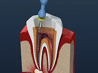 Clinique Dentaire de Meyrin - cliccare per ingrandire l’immagine 29 in una lightbox