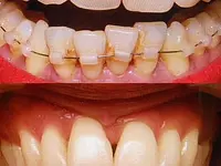 ORTHOLIGHT Orthodontie – click to enlarge the image 7 in a lightbox