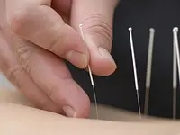 Akupunktur TCM Oberland Praxis Zhao - cliccare per ingrandire l’immagine 5 in una lightbox