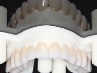 Dental Clinic Biel - cliccare per ingrandire l’immagine 13 in una lightbox