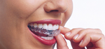 Invisalign®, Spark™