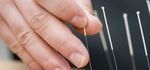 Acupunture