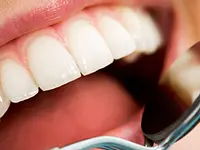 Studio Dentistico Dr. Coler SA – Cliquez pour agrandir l’image 4 dans une Lightbox