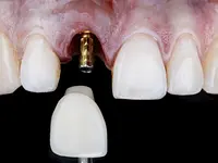 Clinique Dentaire de Meyrin - cliccare per ingrandire l’immagine 10 in una lightbox