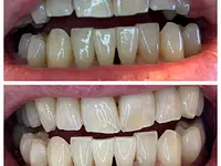 Dentalhygiene Tschan Claudia - cliccare per ingrandire l’immagine 12 in una lightbox