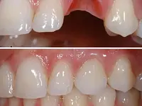 Müller Dental-Technology - cliccare per ingrandire l’immagine 8 in una lightbox