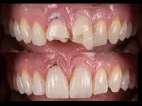 Cabinet dentaire de Bernex – Cliquez pour agrandir l’image 4 dans une Lightbox