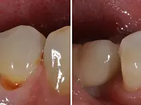 Zahnarztpraxis - Dr. med. dent. Theres Wyss AG - Klicken Sie, um das Bild 6 in einer Lightbox vergrössert darzustellen